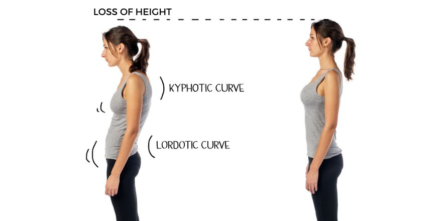 How To Improve Posture  Cayatch – Cayatch Posture Corrector
