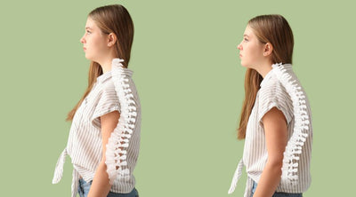 Long Term Effects Of Bad Posture | Take Steps Now!