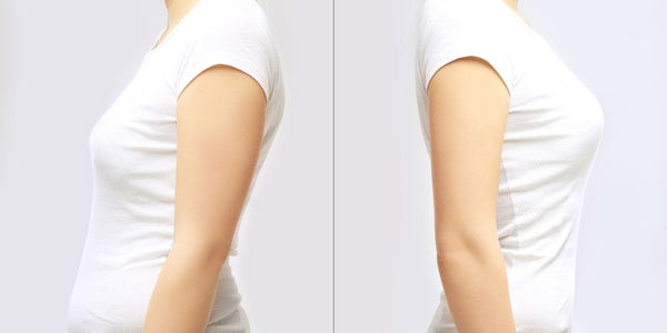 How To Fix Posture? An Elaborate Expert Guide